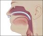 Teleflex Medical назофарингеальная трубка Nasopharyngeal Airway
